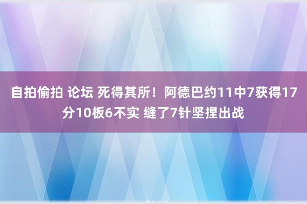 自拍偷拍 论坛 死得其所！阿德巴约11中7获得17分10板6不实 缝了7针坚捏出战